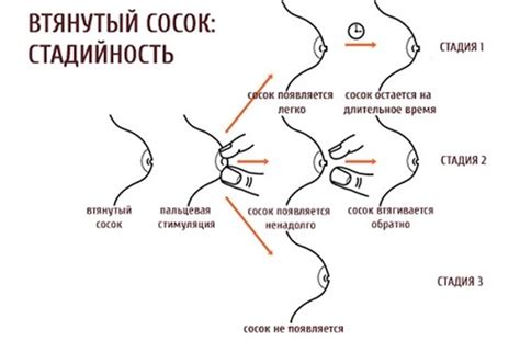Возможные последствия отсутствия сосков у девушек
