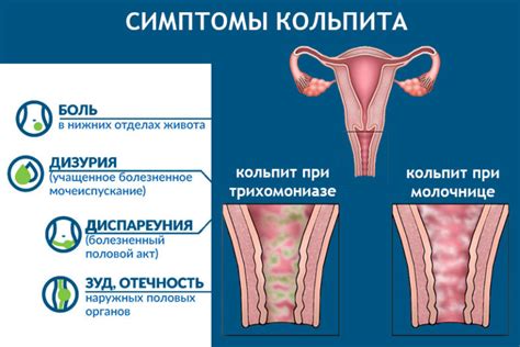 Структурные причины отсутствия сосков у девушек