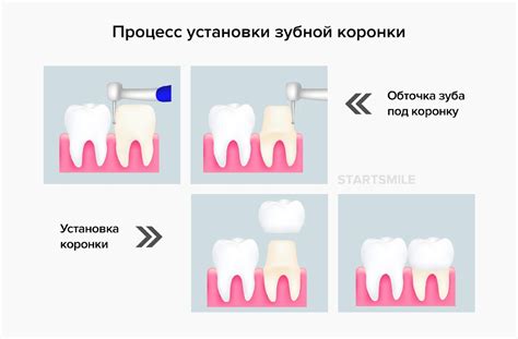 Влияние оцинкования на долговечность кузова