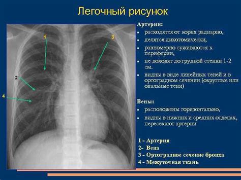 Вред металла при рентгене: 7 фактов, почему лучше избегать его использования