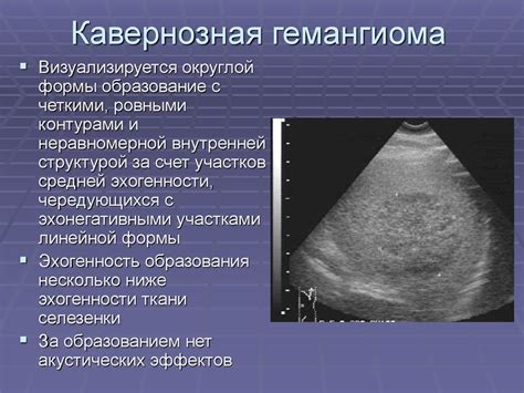 Диагностика гипоплазии селезенки