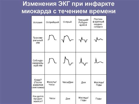 Диагностика нижнего инфаркта неопределенной давности на ЭКГ