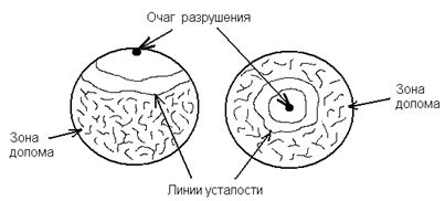 Определение гиподенсного очага