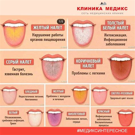 Причины появления привкуса металла во рту после рвоты