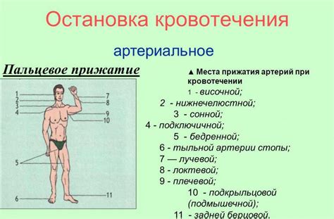 Расстановка и прижатие деталей