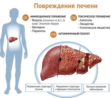 Симптомы гиповаскулярного очага в печени