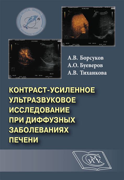 Ультразвуковое исследование печени при гиповаскулярном очаге