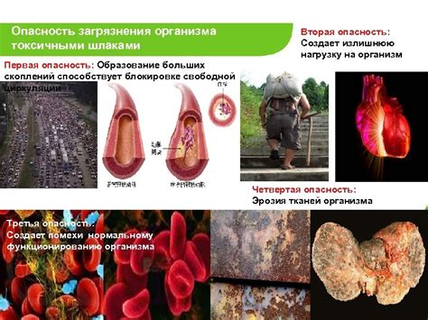  Отравления организма токсичными элементами 